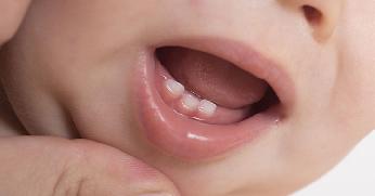 Bayi Tumbuh Gigi Pertama Kali Rewel? Berikut Cara Mengatasinya Moms
